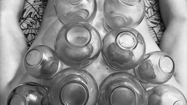 ventouses-montpellier